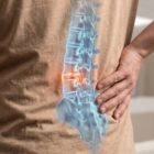 Man holding his lower back caused by a bulging disc.