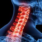 Cervical spine pain highlighted in red