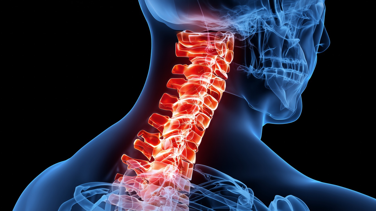 Cervical Spondylosis vs. Stenosis: What’s the Difference?