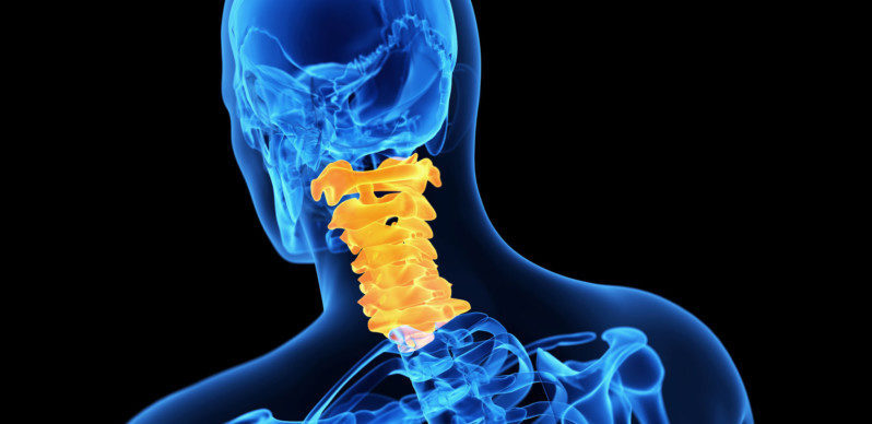 Cervical Laminoplasty for Neck Pain Relief