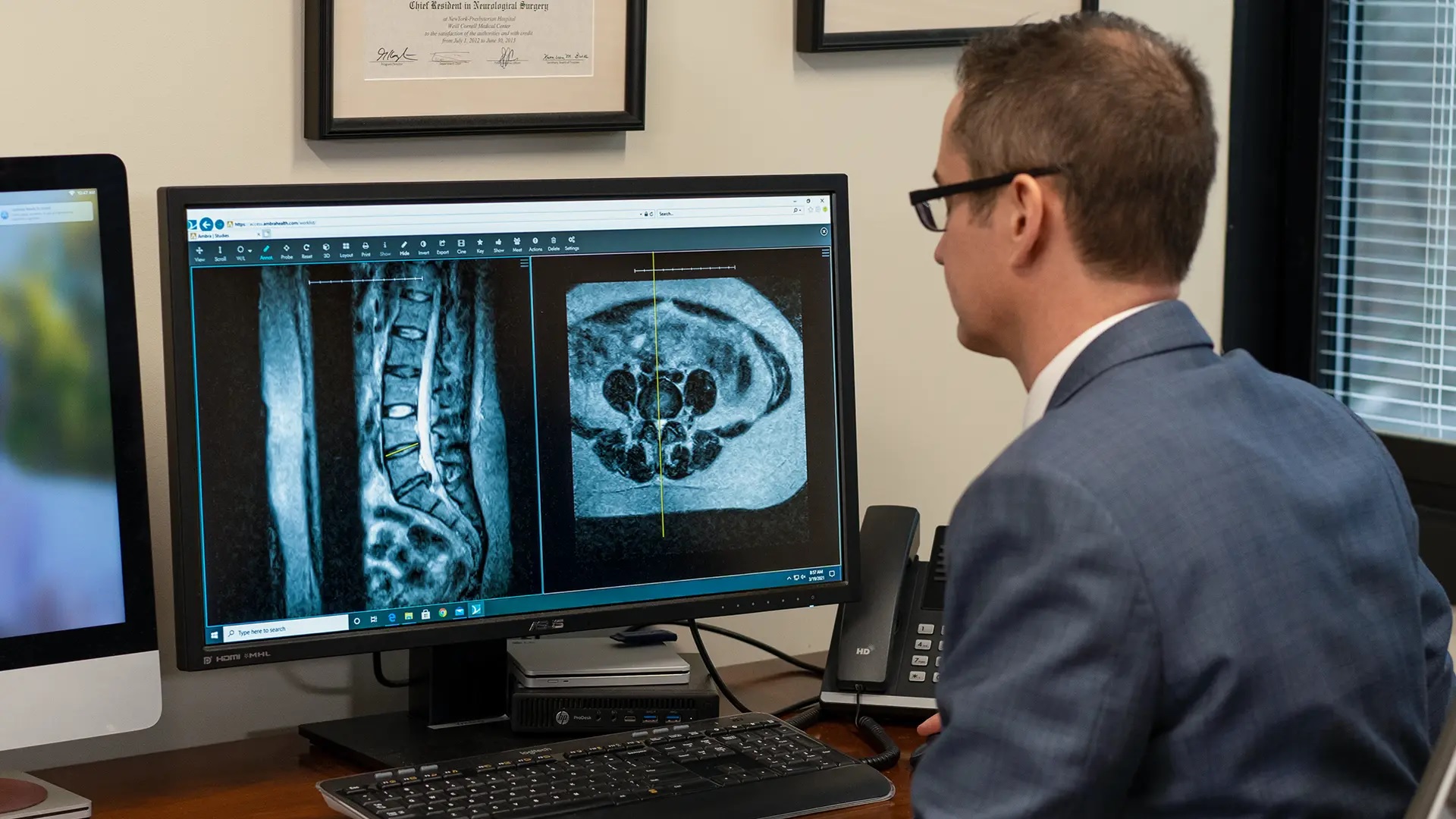 Herniated Disc Treatment Options Explained