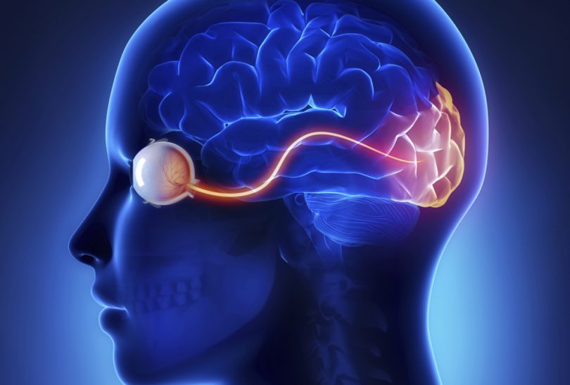 Radiographic Signs of Idiopathic Intracranial Hypertension