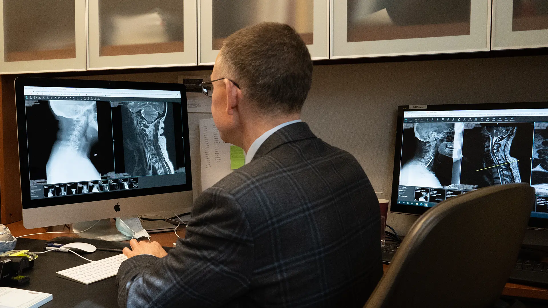 What to Expect From Cervical Spinal Stenosis Surgery Recovery