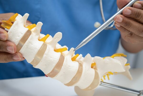 Doctor holding spinal nerve and bone model, Lumbar spine displaced herniated disc.