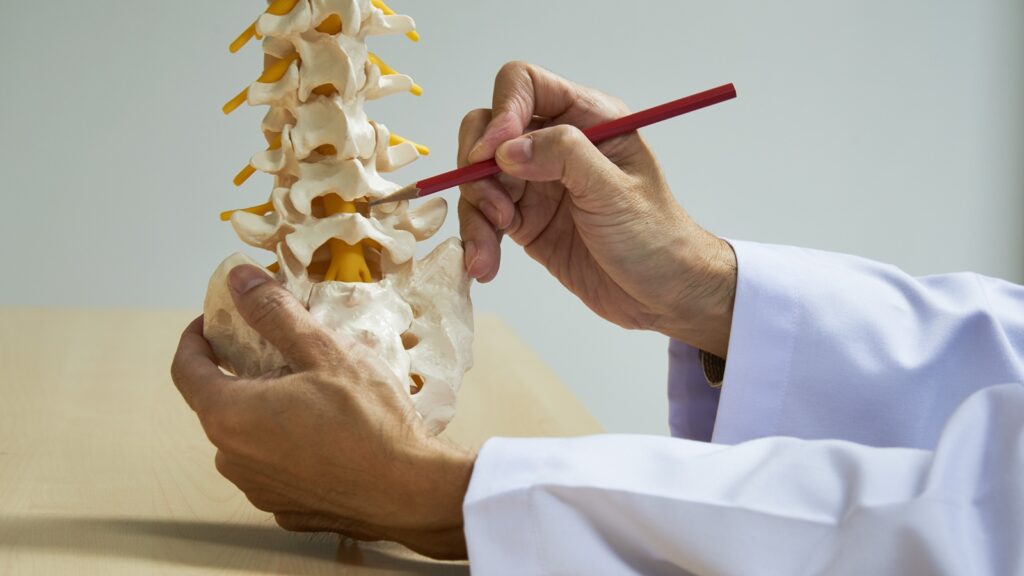 A neurosurgeon demonstrating Lumbar Spondylolisthesis on a model.