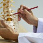 A neurosurgeon demonstrating Lumbar Spondylolisthesis on a model.