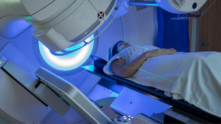 Stereotactic Radiosurgery for Brain Metastases in NSCLC