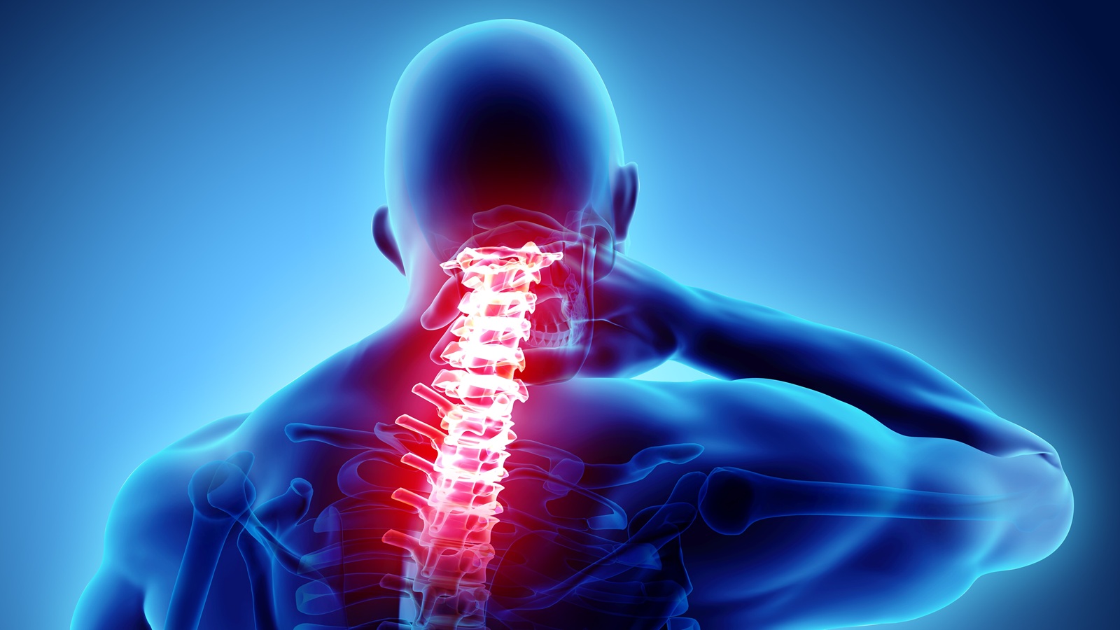 Signs You Need Neck Surgery: When Is Cervical Spine Surgery Necessary?