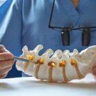 A neurosurgeon pointing at lumbar vertebra model