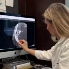 Dr. Dorothea Altschul, a pioneer in the condition of Pulsatile Tinnitus, reviews the scan of a patient presenting with the condition.