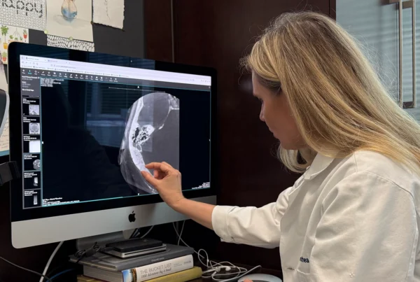 Dr. Dorothea Altschul, a pioneer in the condition of Pulsatile Tinnitus, reviews the scan of a patient presenting with the condition.