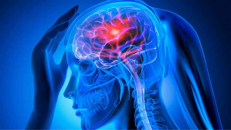 Brain Aneurysm and Stroke Recovery