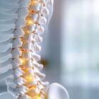 A visual representation of a human spine and hips with highlighted areas indicating pain.