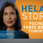 Hela talks about her Acoustic Neuroma surgery.