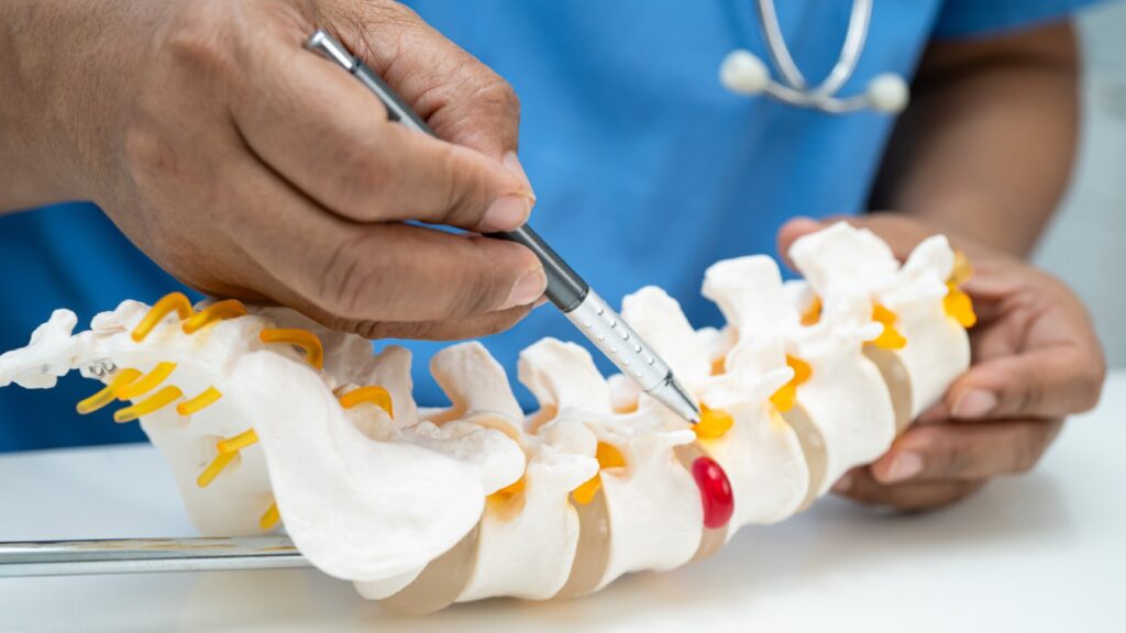 Doctor explaining herniated discs vs spinal stenosis using a spine.