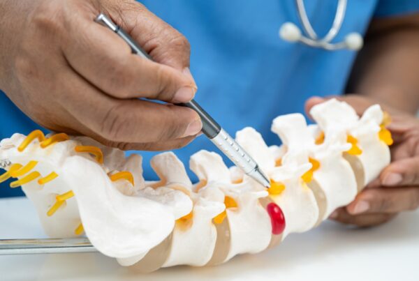 Doctor explaining herniated discs vs spinal stenosis using a spine.