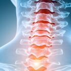 image of a cervical spine.