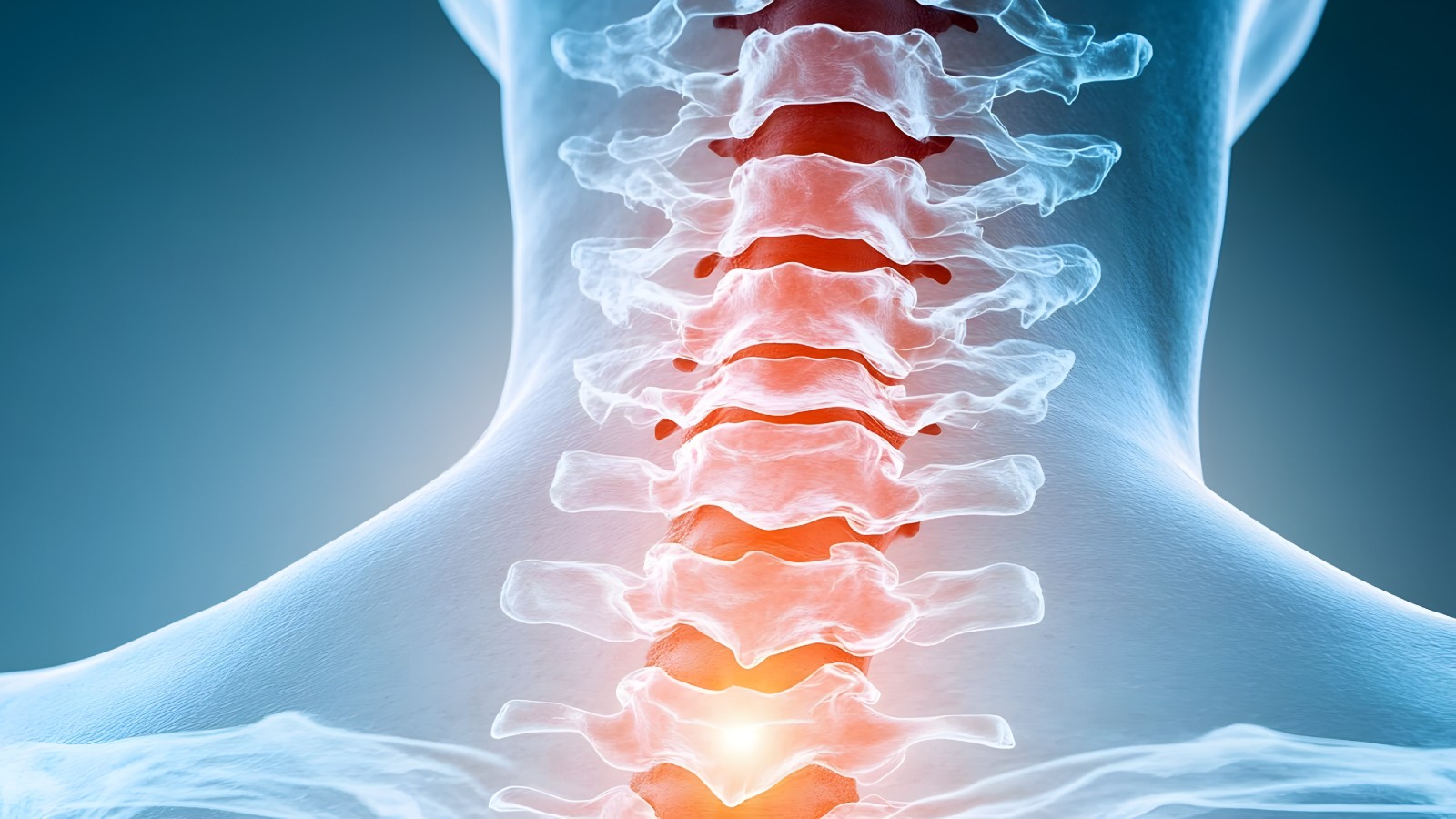 Comprehensive Guide to Recovering from Neck Surgery