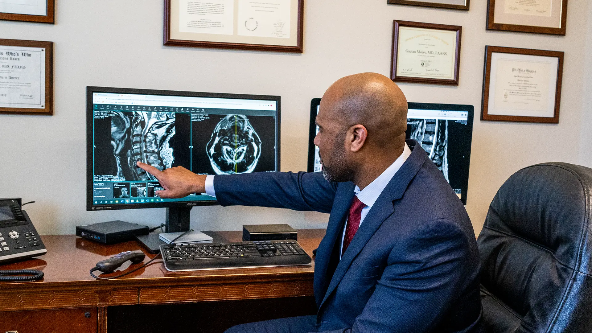 Arnold Chiari Malformation: Type 1 Vs. Type 2