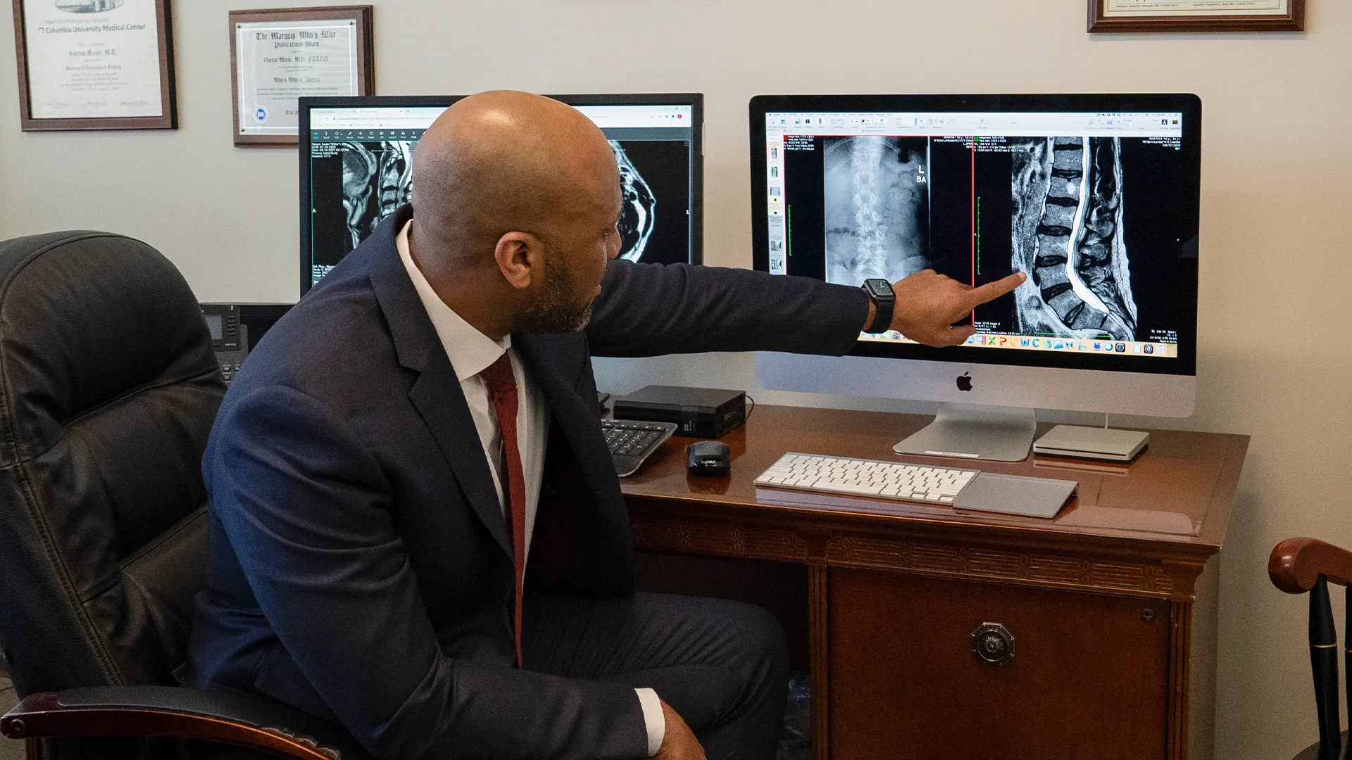 Pars Defect – A Neurosurgical Overview