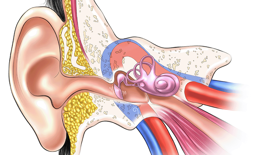 Pulsatile tinnitus, how does it look like