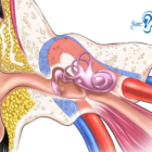 Pulsatile Tinnitus Causes