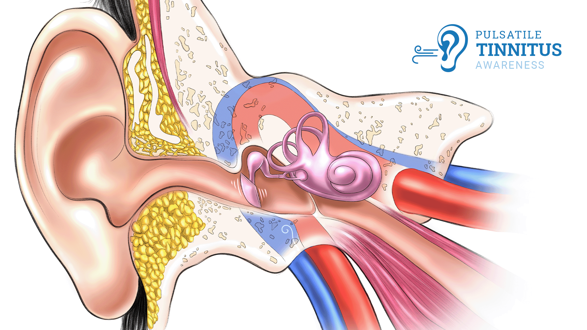 Ask the doctor: Is it worrisome to hear a pulse in my ear