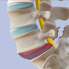 Human spondylolisthesis anatomy medical illustration.