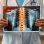 Doctor looking at an X-ray of a spine.