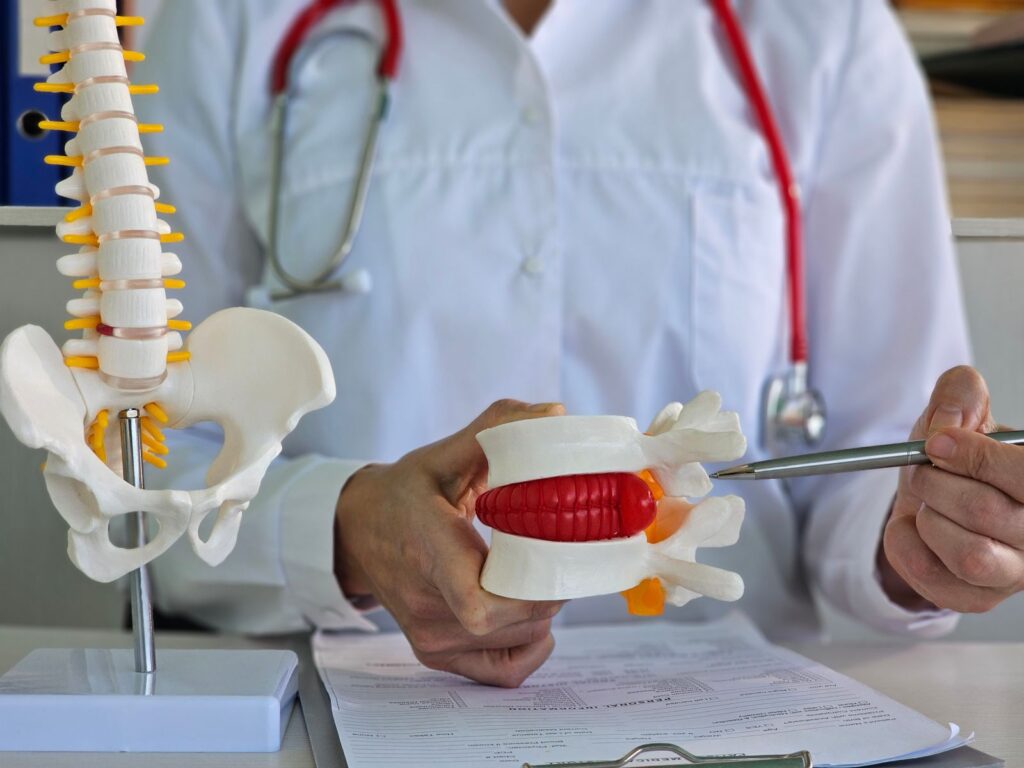 Doctor explaining risks of not having acdf surgery.