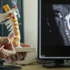 A neurosurgeon pointing and demonstrating anatomy of human cervical spine model