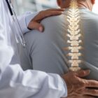 Doctor checking medical examination of spine on man's back and neck, as a check in after spinal fusion.