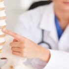 Doctor explaining spinal stenosis using a model of a spine.