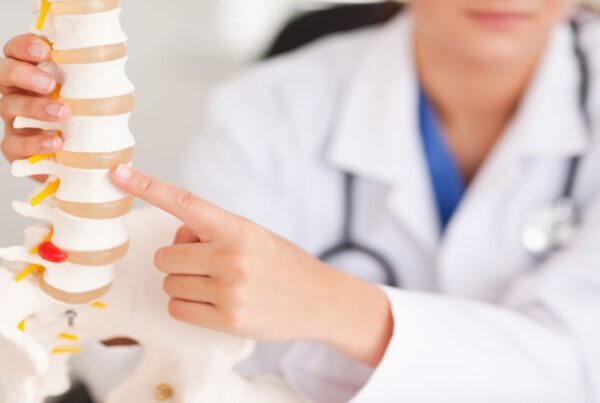 Doctor explaining spinal stenosis using a model of a spine.