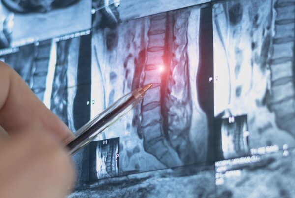 Doctor looking at MRI scan of a spine.