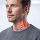 Man with cervical radiculopathy.
